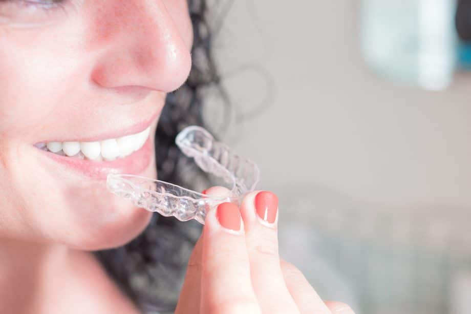 How To Clean Your Invisalign Trays